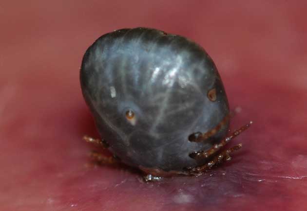 足に食いついたマダニの写真