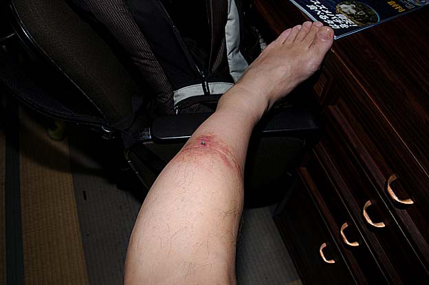 マダニのついた足の状態